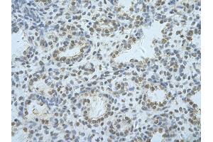 Rabbit Anti-HNRNPF Antibody       Paraffin Embedded Tissue:  Human alveolar cell   Cellular Data:  Epithelial cells of renal tubule  Antibody Concentration:   4.