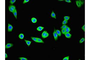 Immunofluorescent analysis of HepG2 cells using ABIN7174296 at dilution of 1:100 and Alexa Fluor 488-congugated AffiniPure Goat Anti-Rabbit IgG(H+L) (USP25 antibody  (C-Term))