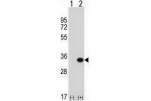Western blot analysis of GCLM (arrow) using GCLM / GLCLR Antibody (C-term) Cat.