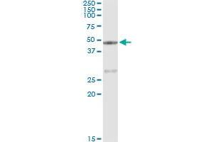 Immunoprecipitation of CPA1 transfected lysate using anti-CPA1 monoclonal antibody and Protein A Magnetic Bead , and immunoblotted with CPA1 MaxPab rabbit polyclonal antibody. (CPA1 antibody  (AA 1-419))