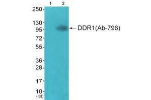 Western blot analysis of extracts from JK cells (Lane 2), using DDR1 (Ab-796) antiobdy. (DDR1 antibody  (Tyr796))