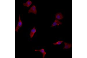 ABIN6262952 and ABIN6277129 staining HepG2 by IF/ICC. (LETMD1 antibody  (N-Term))