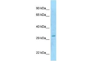 WB Suggested Anti-SAP30BP Antibody Titration: 1. (SAP30BP antibody  (N-Term))