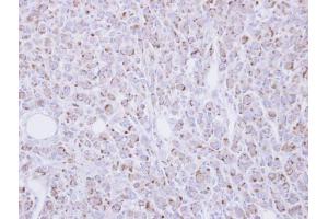 IHC-P Image Immunohistochemical analysis of paraffin-embedded U87 xenograft, using RGMB, antibody at 1:100 dilution. (RGMB antibody  (Center))