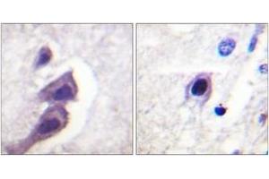 Immunohistochemistry (IHC) image for anti-Tuberous Sclerosis 2 (TSC2) (AA 1428-1477) antibody (ABIN2888711) (Tuberin antibody  (AA 1428-1477))