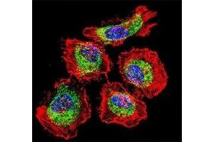 Confocal immunofluorescent analysis of Vimentin antibody with HeLa cells followed by Alexa Fluor 488-conjugated goat anti-rabbit lgG (green). (Vimentin antibody)