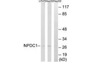Western blot analysis of extracts from HepG2/LOVO cells, using NPDC1 Antibody. (NPDC1 antibody  (AA 189-238))