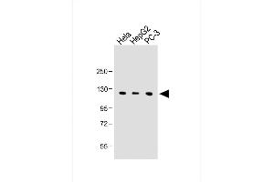 All lanes : Anti-C15orf2 Antibody (Center) at 1:1000 dilution Lane 1: Hela whole cell lysate Lane 2: HepG2 whole cell lysate Lane 3: PC-3 whole cell lysate Lysates/proteins at 20 μg per lane.