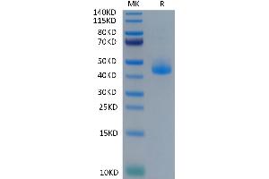 Cynomolgus CD3E on Tris-Bis PAGE under reduced condition. (CD3 epsilon Protein (CD3E) (Fc Tag))