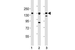 AXL antibody at 1:2000 dilution. (AXL antibody  (AA 838-872))