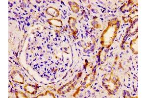 IHC image of ABIN7161406 diluted at 1:500 and staining in paraffin-embedded human kidney tissue performed on a Leica BondTM system. (PNPLA6 antibody  (AA 345-493))