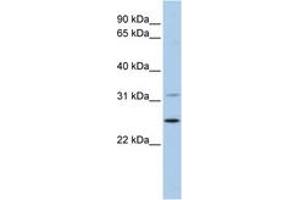 Image no. 1 for anti-Dehydrogenase/reductase (SDR Family) Member 1 (DHRS1) (AA 36-85) antibody (ABIN6743656) (DHRS1 antibody  (AA 36-85))