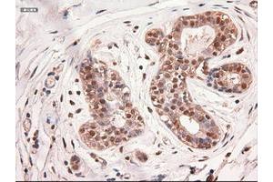 Image no. 2 for anti-Myc Proto-Oncogene protein (MYC) antibody (ABIN1497013) (c-MYC antibody)