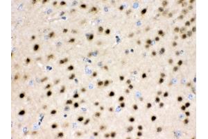 Anti- HDAC11 Picoband antibody,IHC(P) IHC(P): Rat Brain Tissue (HDAC11 antibody  (N-Term))