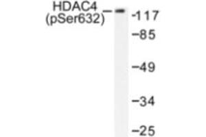 Image no. 1 for anti-Histone Deacetylase 4 (HDAC4) (pSer632) antibody (ABIN318180) (HDAC4 antibody  (pSer632))