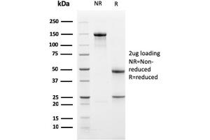 Western Blotting (WB) image for anti-BCL2-Like 1 (BCL2L1) (AA 1-135) antibody (ABIN6940516) (BCL2L1 antibody  (AA 1-135))