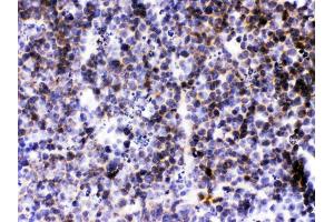CXCL13/BLC was detected in paraffin-embedded sections of mouse lymphaden tissues using rabbit anti- CXCL13/BLC Antigen Affinity purified polyclonal antibody (Catalog # ) at 1 ? (CXCL13 antibody  (AA 22-109))