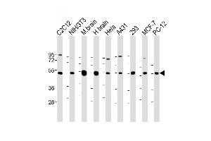 All lanes : Anti-beta II Tubulin Antibody at 1:2000 dilution Lane 1: C2C12 whole cell lysate Lane 2: NIH/3T3 whole cell lysate Lane 3: Mouse brain lysate Lane 4: Human brain lysate Lane 5: Hela whole cell lysate Lane 6: A431 whole cell lysate Lane 7: 293 whole cell lysate Lane 8: MCF-7 whole cell lysate Lane 9: PC-12 whole cell lysate Lysates/proteins at 20 μg per lane. (TUBB2A antibody  (AA 194-225))