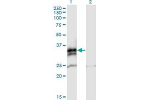 Western Blot analysis of FCN2 expression in transfected 293T cell line by FCN2 MaxPab polyclonal antibody. (Ficolin 2 antibody  (AA 1-313))