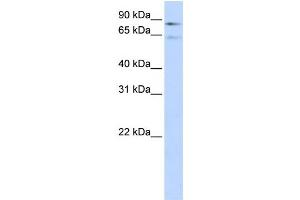 Western Blotting (WB) image for anti-Coagulation Factor 13, B Polypeptide (F13B) antibody (ABIN2458621)