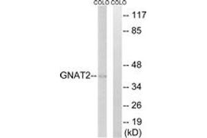 Western blot analysis of extracts from COLO cells, using GNAT2 Antibody. (GNAT2 antibody  (AA 1-50))