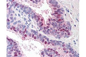 Anti-TARBP1 antibody IHC of human prostate. (TARBP1 antibody  (Internal Region))