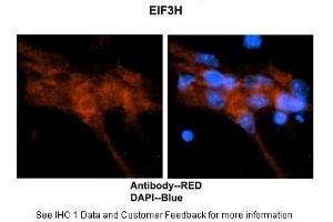 Researcher: Dr. (EIF3H antibody  (N-Term))