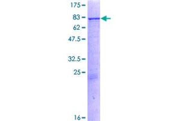 CYP11A1 Protein (AA 1-521) (GST tag)