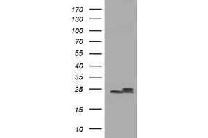 Image no. 9 for anti-NADH Dehydrogenase (Ubiquinone) 1 beta Subcomplex, 10, 22kDa (NDUFB10) antibody (ABIN1499672) (NDUFB10 antibody)