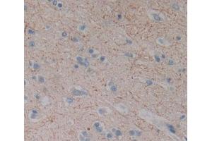 #VALUE! (DLG5 antibody  (AA 1722-1905))