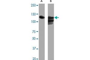 Western blot analysis of SIRT1 polyclonal antibody  expression in Hela (A) and Hela + CoC 12  (B) whole cell lysates. (SIRT1 antibody  (C-Term))