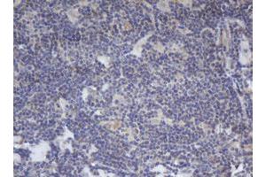 Image no. 1 for anti-B-Cell CLL/lymphoma 10 (BCL10) antibody (ABIN1496847) (BCL10 antibody)