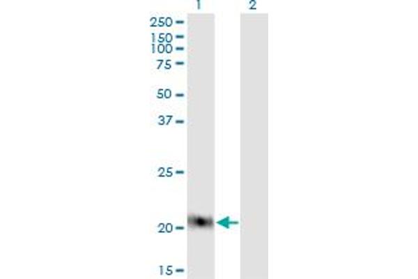 Claudin 1 antibody  (AA 1-211)