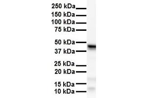 WB Suggested Anti-SMYD5 antibody Titration: 1 ug/mL Sample Type: Human Hela (SMYD5 antibody  (C-Term))