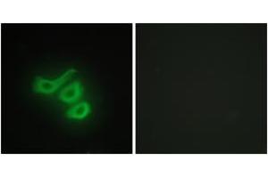 Immunofluorescence analysis of HepG2 cells, using M-CK Antibody. (CKM antibody  (AA 10-59))