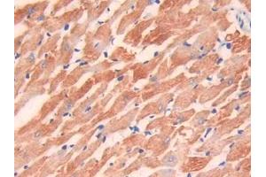IHC-P analysis of Rat Heart Tissue, with DAB staining. (TNNI3 antibody  (AA 1-211))