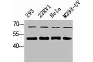 Western Blot analysis of 823 22RV1 HELA 293-UV cells using Smad2/3 Polyclonal Antibody (SMAD2 / SMAD3 antibody)