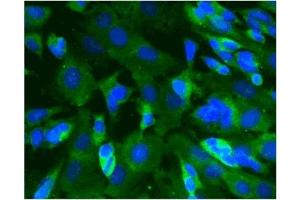 Immunofluorescence (IF) image for anti-Calcium/calmodulin-Dependent Protein Kinase II alpha (CAMK2A) (AA 448-460) antibody (ABIN968458) (CAMK2A antibody  (AA 448-460))