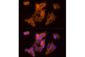 Immunofluorescence analysis of HepG2 cells using CLIC1 Rabbit pAb (ABIN6128983, ABIN6138719, ABIN6138721 and ABIN6217770) at dilution of 1:150 (40x lens).