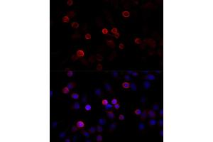 Immunofluorescence analysis of HeLa cells using FLNC antibody (ABIN6127928, ABIN6140681, ABIN6140682 and ABIN6216847) at dilution of 1:100 (40x lens).