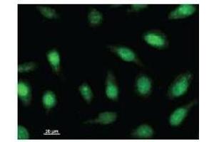 Immunostaining analysis in HeLa cells. (ARNTL2 antibody)
