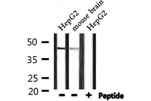 Western Blotting (WB) image for anti-Cell Adhesion Molecule 2 (CADM2) (Internal Region) antibody (ABIN6257823)