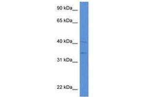 Image no. 1 for anti-Lipase A, Lysosomal Acid, Cholesterol Esterase (LIPA) (AA 42-91) antibody (ABIN6746942) (Lipase A antibody  (AA 42-91))