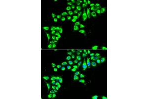 Immunofluorescence analysis of HeLa cells using CLDN2 antibody (ABIN6127703, ABIN6138684, ABIN6138687 and ABIN6222231). (Claudin 2 antibody  (AA 30-230))