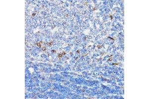 Immunohistochemistry of paraffin-embedded rat spleen using NDE1 antibody. (NDE1 antibody  (AA 1-110))
