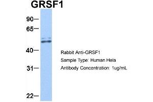 Host:  Rabbit  Target Name:  GRSF1  Sample Type:  Hela  Antibody Dilution:  1. (GRSF1 antibody  (Middle Region))