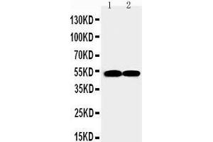 Anti-FLI1 antibody, Western blotting Lane 1: JURKAT Cell Lysate Lane 2: RAJI Cell Lysate
