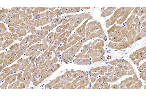 Detection of ACTC1 in Human Cardiac Muscle Tissue using Monoclonal Antibody to Actin Alpha 1, Cardiac Muscle (ACTC1) (ACTC1 antibody  (AA 156-368))