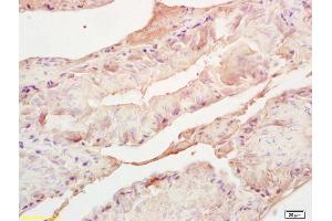 Formalin-fixed and paraffin embedded mouse testis labeled with Rabbit Anti Adrenodoxin/FDX Polyclonal Antibody, Unconjugated (ABIN1387317) at 1:200 followed by conjugation to the secondary antibody and DAB staining (Adrenodoxin (AA 51-150) antibody)