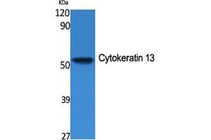 Western Blot (WB) analysis of specific cells using Cytokeratin 13 Polyclonal Antibody. (Cytokeratin 13 antibody  (Internal Region))